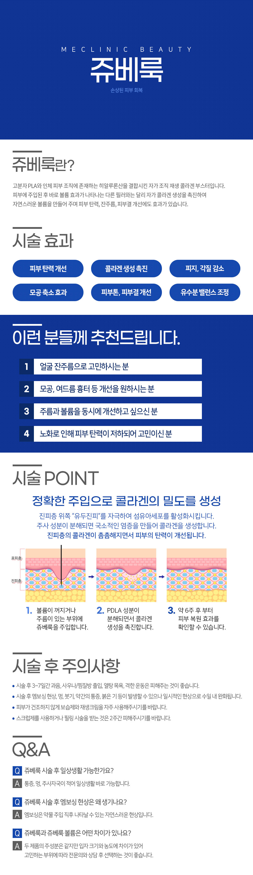 쥬베룩 컨텐츠
