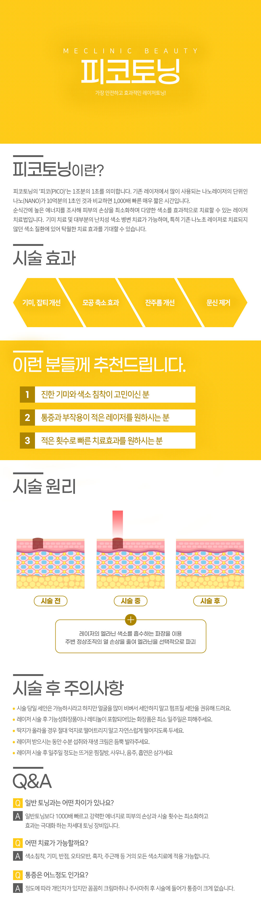 피코토닝 컨텐츠