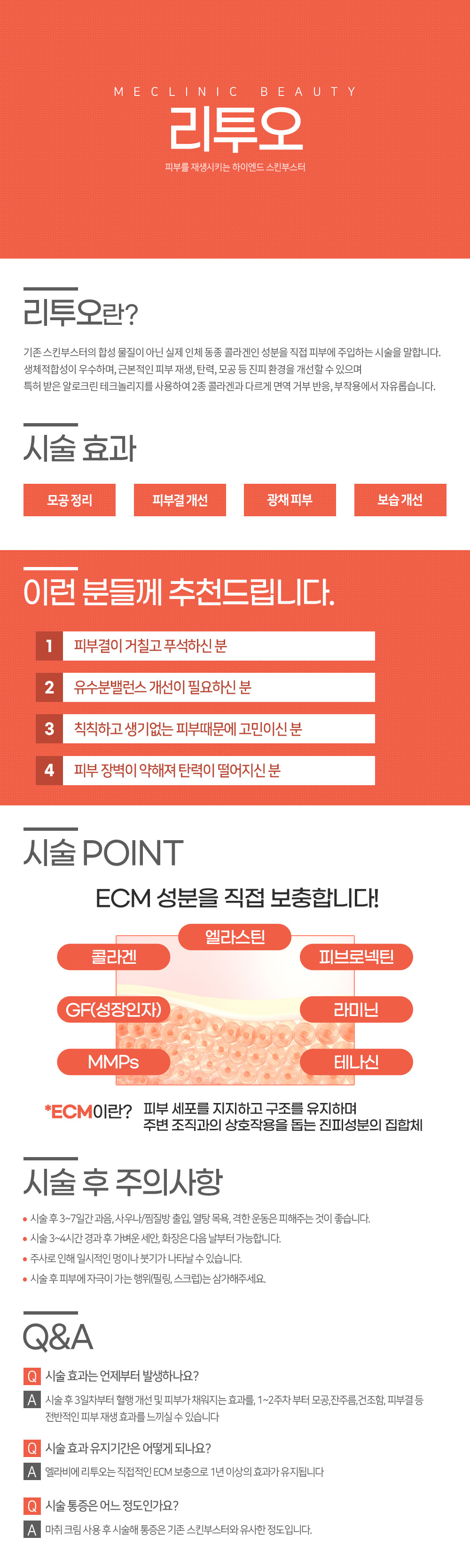 리투오 컨텐츠